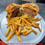 Big Mike's Heart Attack with Fries
